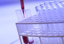 Provette test