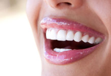 sorriso
