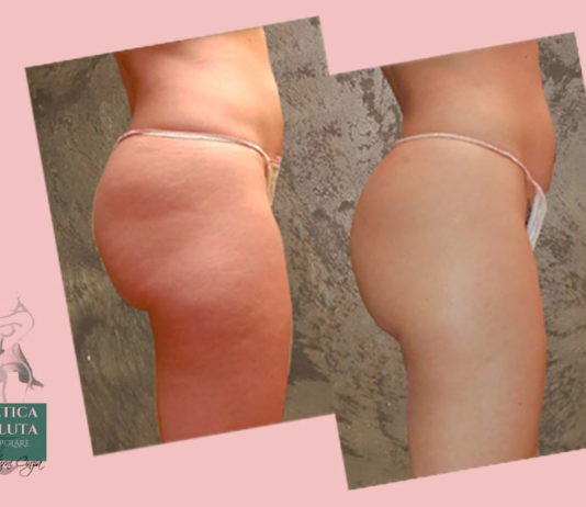 Torna in forma con Mack Pharm estetica evolutiva