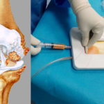 CELLULE-MESENCHIMALI-DA-TESSUTO-ADIPOSO