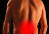 OZONO TERAPIA ECOGUIDATA